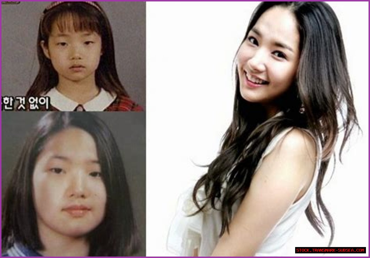 Park Min Young's Transformation: Uncovering The Journey Before Surgery